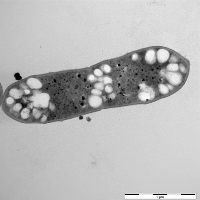 TEM micrograph of Acetobacterium woodii [p83_PHB_Scaceti] (recombinant derivative of DSM 1030)