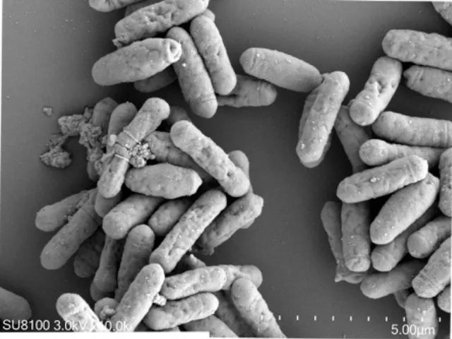 SEM micrograph of Clostridium butyricum YF1