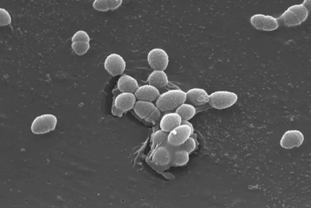 SEM micrograph of Enterococcus faecalis