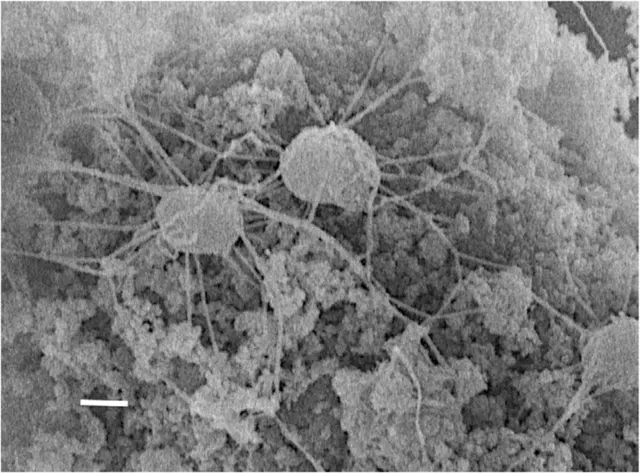 SEM micrograph of “Geoglobus ahangari” strain 234T