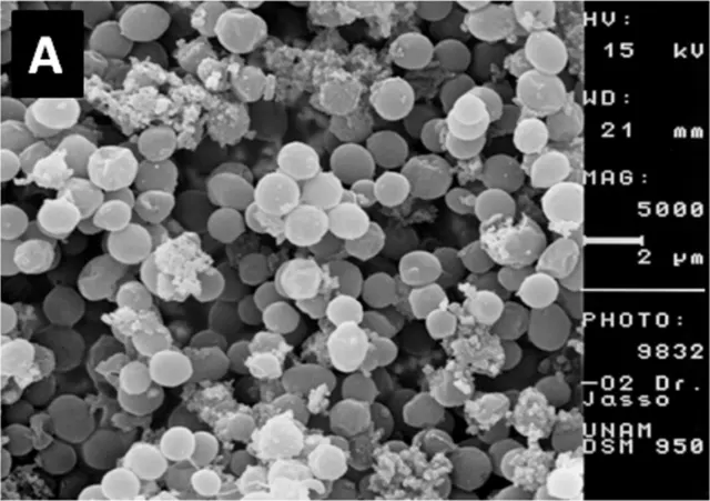 SEM micrograph of Methanosarcina acetivorans C2A (DSM 2834)