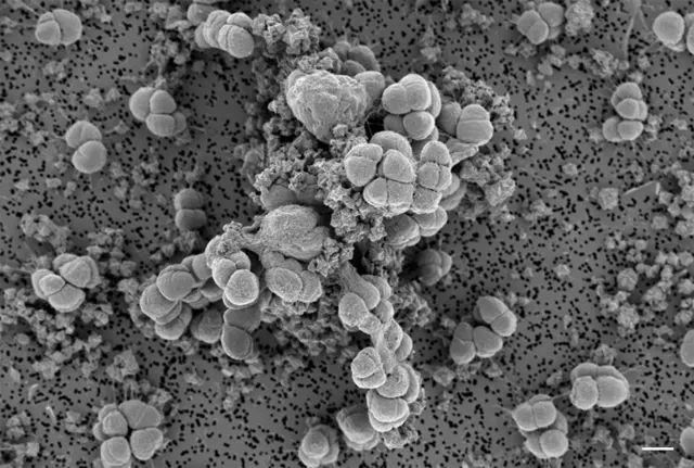 SEM micrograph of Methanosarcina barkeri strain Fusaro