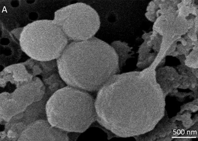 SEM micrograph of Moorella thermoacetica ATCC 39073