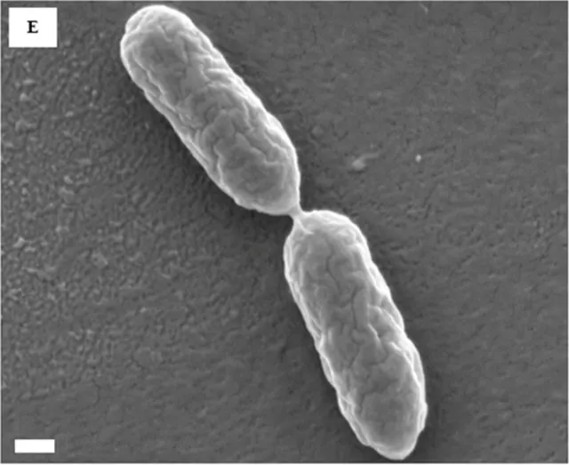 SEM micrograph of P. aeruginosa PA14