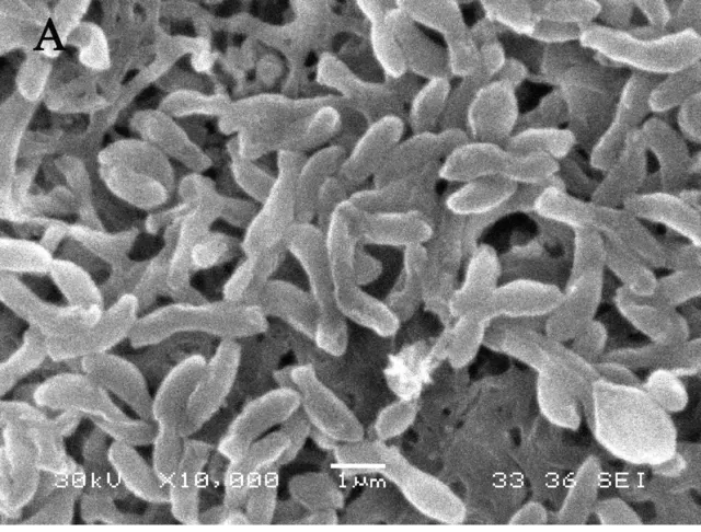 SEM micrograph of Rhodopseudomonas palustris strain N