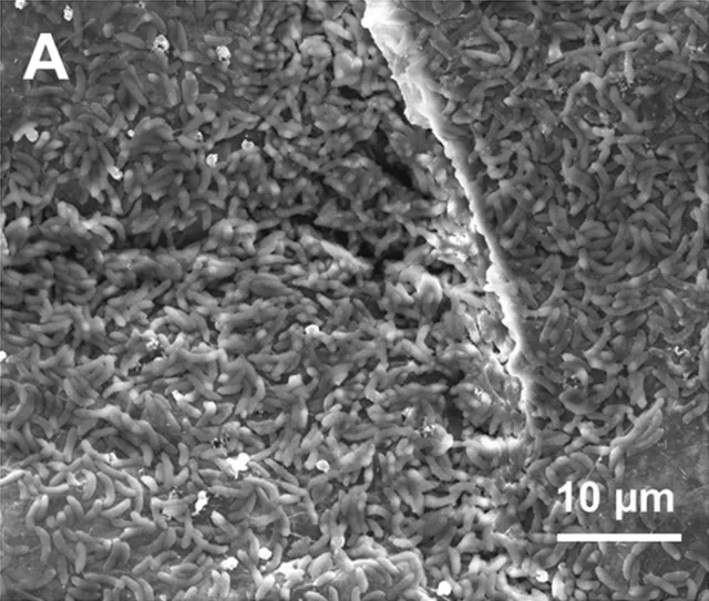 SEM micrograph of Sporomusa ovata DSM 2662