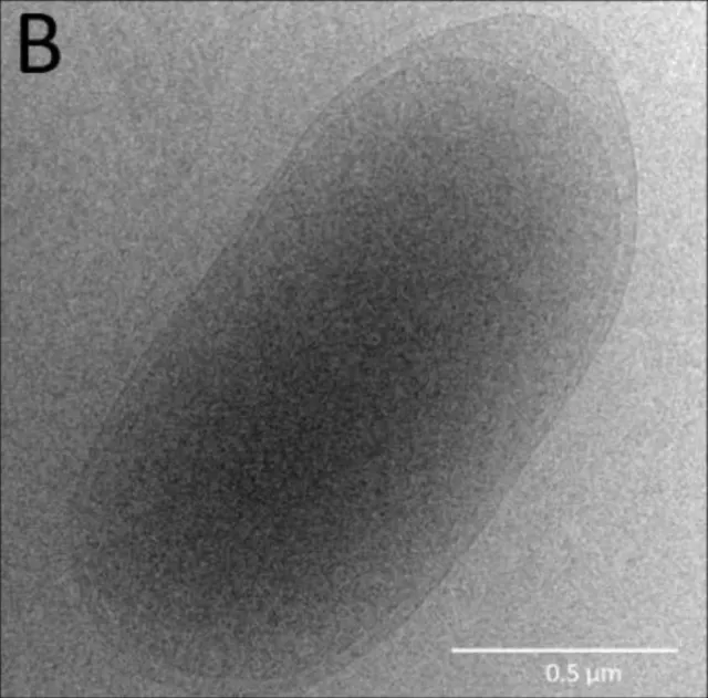 cryo-EM micrograph of Thauera aminoaromatica MZ1T